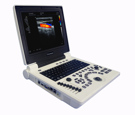 220mm Depth Color Doppler Ultrasound Machine 3D Medical Ultrasound Instruments